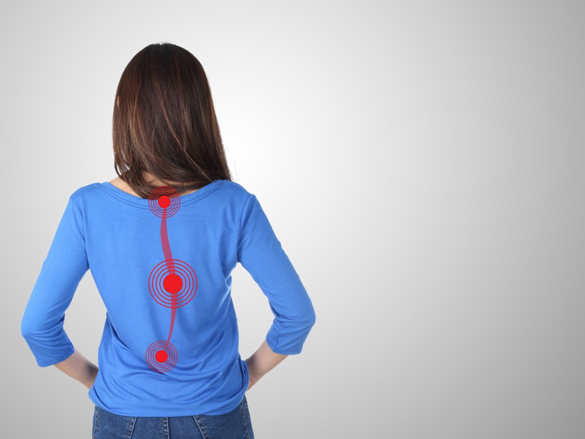 Preparing Kids for Spine&nbsp;Surgery